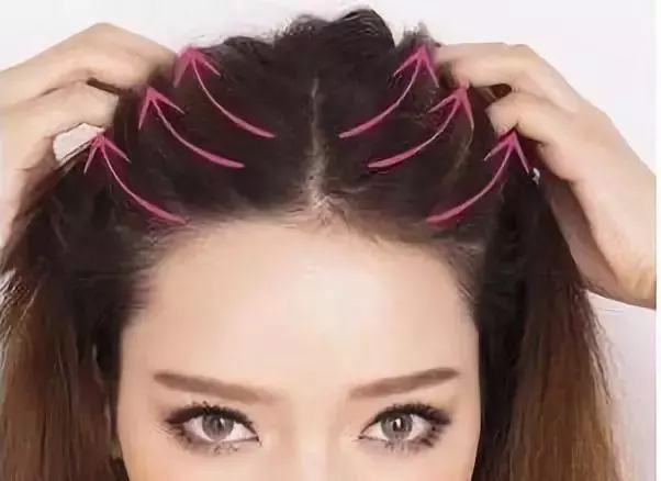 气血不好，人易老！从这5个部位就能看出来(图8)