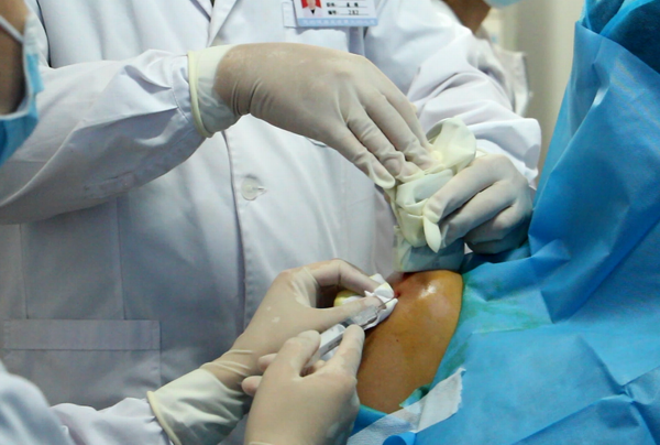 肩关节反复疼痛不要急,精准治疗解难题(图5) 肩关节反复疼痛不要急,精准治疗解难题(图5)