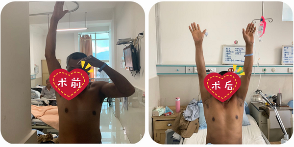 肩关节反复疼痛不要急,精准治疗解难题(图7) 肩关节反复疼痛不要急,精准治疗解难题(图7)