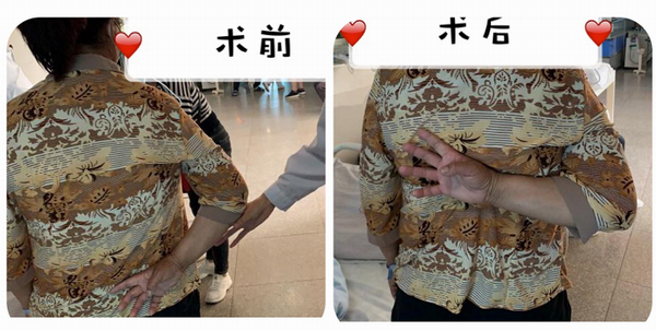 肩关节反复疼痛不要急,精准治疗解难题(图8) 肩关节反复疼痛不要急,精准治疗解难题(图8)